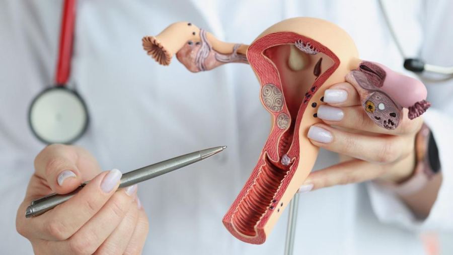 Dokter Ingatkan Bahaya HPV, Picu Kutil Kelamin hingga Kanker Serviks