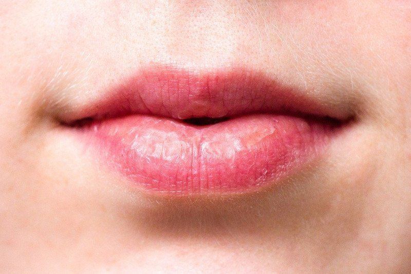 9 cara mengatasi bibir kering dan pecah-pecah saat kemarau