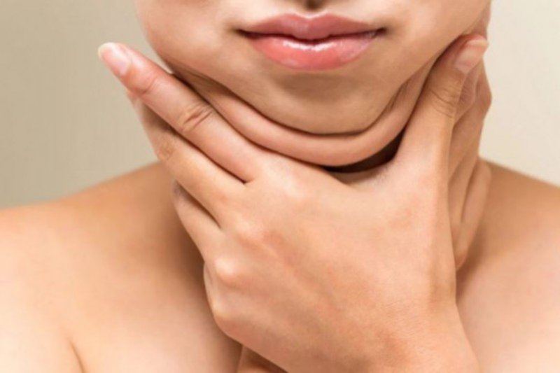 6 cara menghilangkan double chin agar dagu terlihat lebih tirus