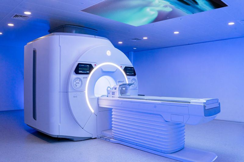 MRI 3 Tesla berbasis AI dukung percepatan diagnosis stroke