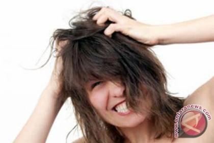 Apakah ketombe menular? Ini fakta dan penyebabnya