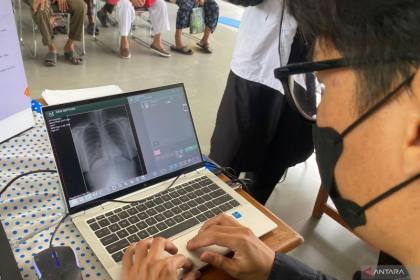 16.013 warga Jaksel jalani skrining TB melalui CKG hingga Agustus 2026