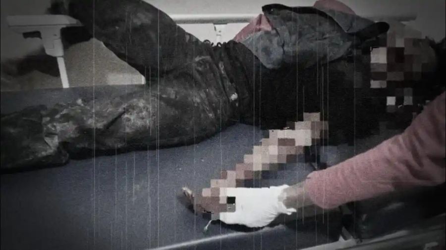 Pesta Miras Berdarah di Konawe Selatan, Petani di Angata Ditebas Teman Minum Usai Lempar Kursi