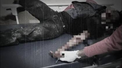 Pesta Miras Berdarah di Konawe Selatan, Petani di Angata Ditebas Teman Minum Usai Lempar Kursi
