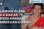 Kisah Heroik Relawan Karhutla Palangka Raya, Alami Luka Bakar saat Selamatkan Pemukiman Warga