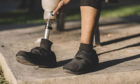 Cara Mendapatkan Kaki Palsu Ditanggung BPJS Kesehatan hingga Bantuan Rp2,75 Juta, Simak 7 Syaratnya
