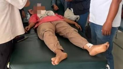 Emak-emak Alami Luka Usai Tabrakan di Jl Poros Punggaluku-Torobulu Konawe Selatan, Rugi Rp500 Ribu